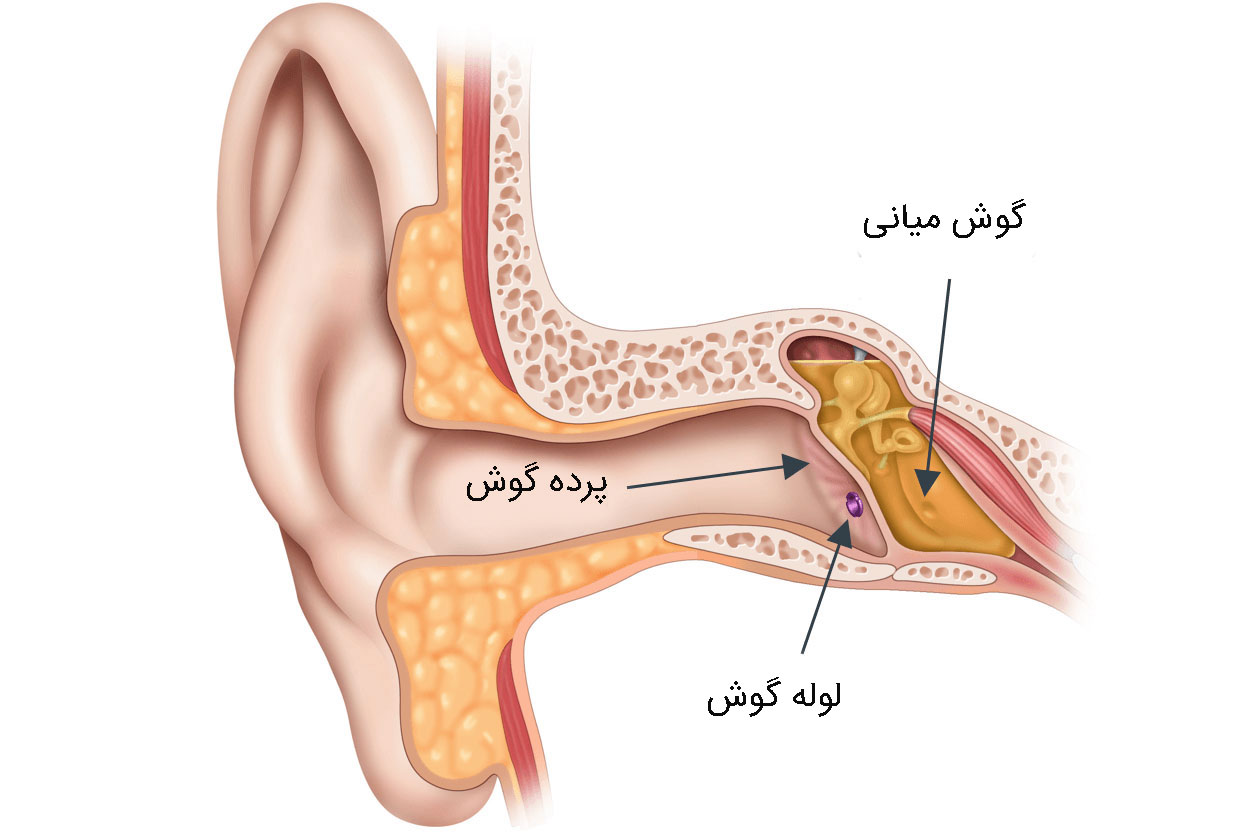 انواع عفونت گوش میانی 